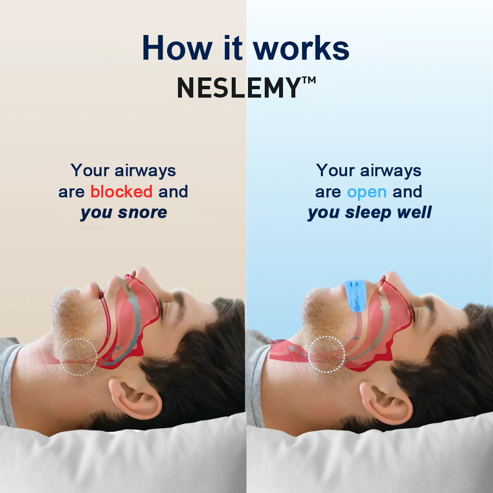⭐🎉Countdown to 2026: 60% OFF⭐🎉 Professional intelligent anti-snoring device